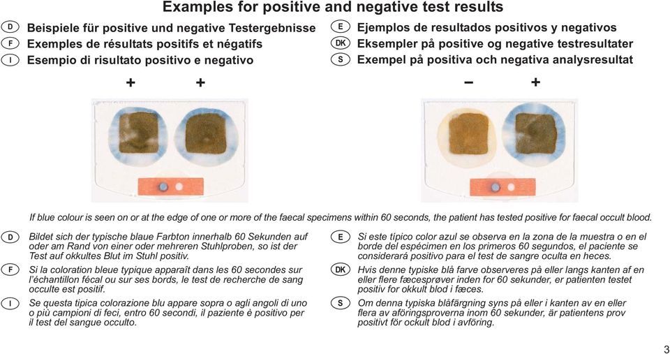 of the faecal specimens within 60 seconds, the patient has tested positive for faecal occult blood.