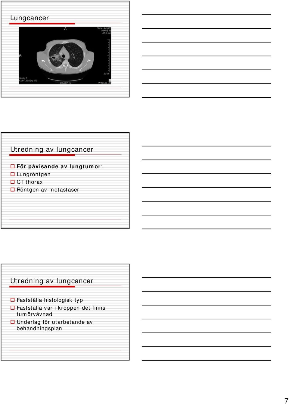 lungcancer Fastställa histologisk typ Fastställa var i kroppen