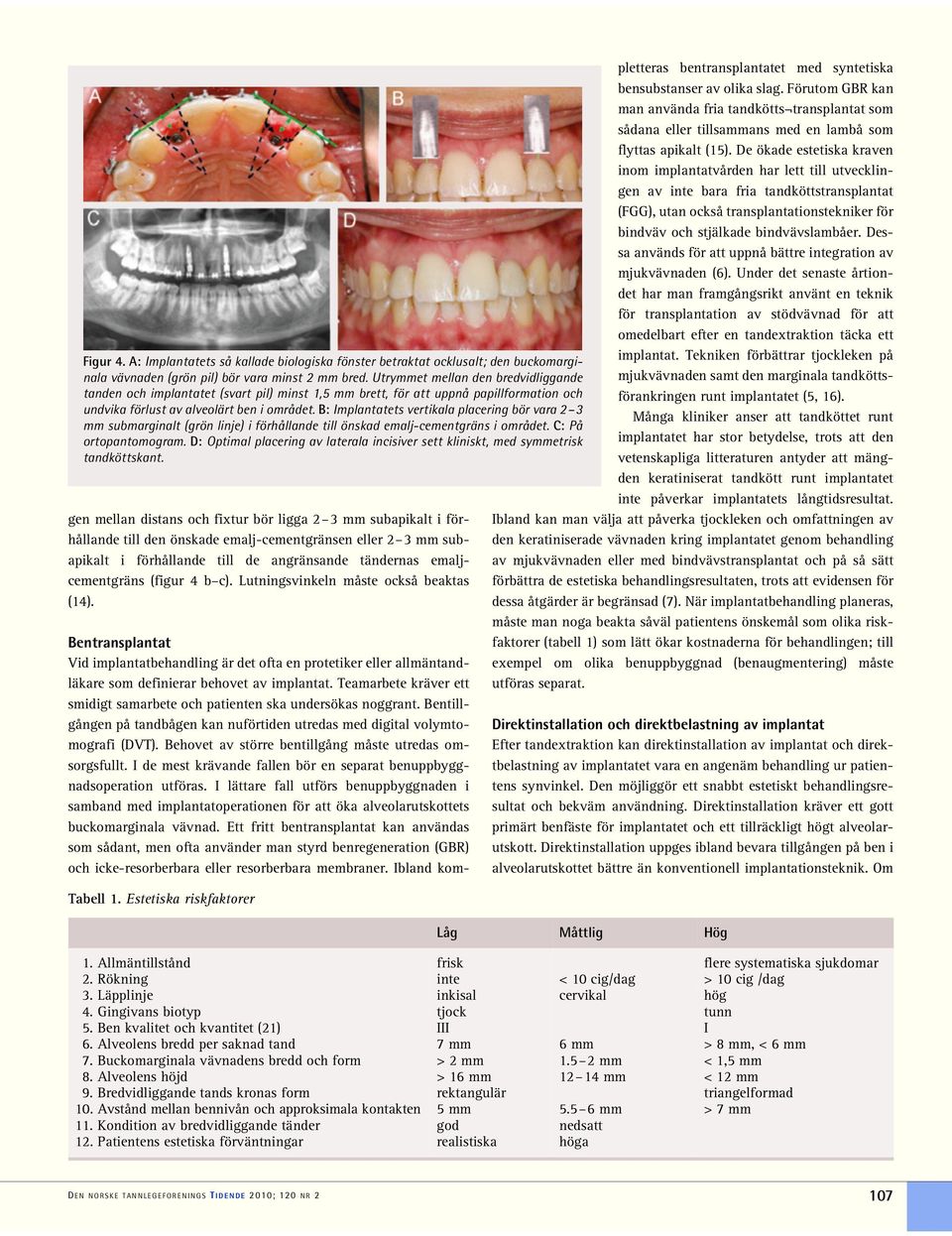 B: Implantatets vertikala placering bör vara 2 3 mm submarginalt (grön linje) i förhållande till önskad emalj-cementgräns i området. C: På ortopantomogram.