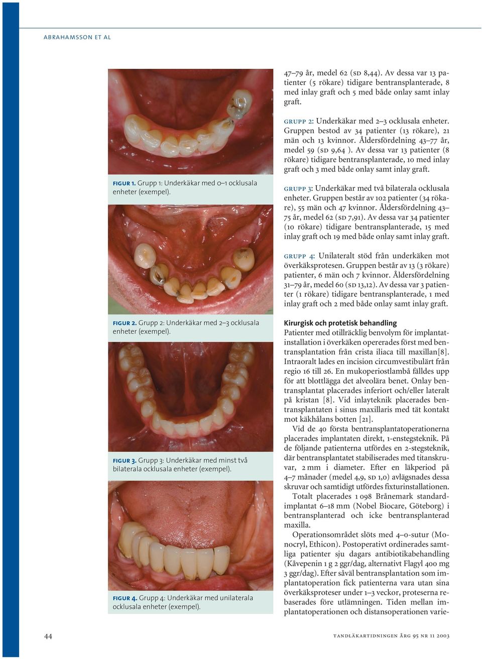 Av dessa var 13 patienter (8 rökare) tidigare bentransplanterade, 10 med inlay graft och 3 med både onlay samt inlay graft. figur 1. Grupp 1: Underkäkar med 0 1 ocklusala enheter (exempel).