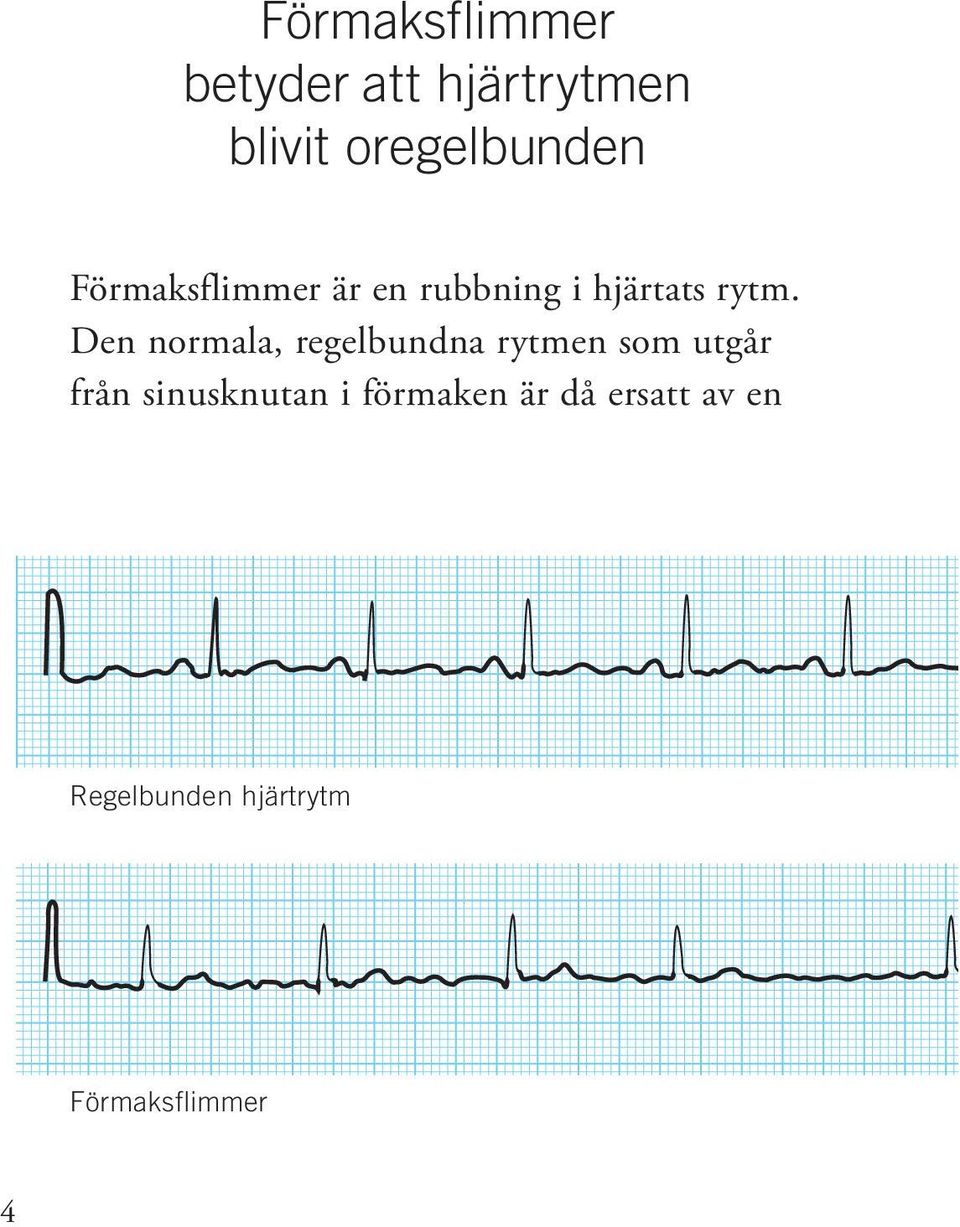 Den normala, regelbundna rytmen som utgår från sinusknutan