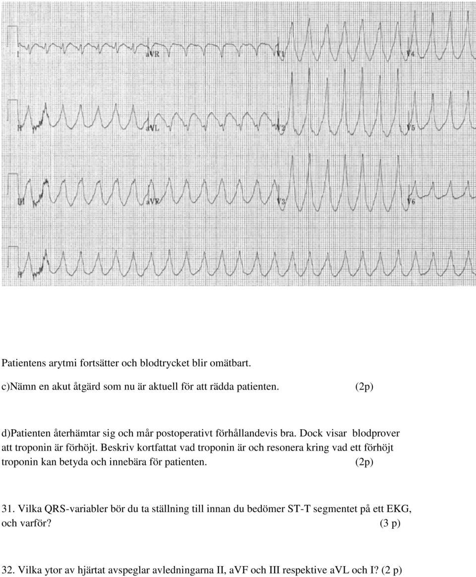 Beskriv kortfattat vad troponin är och resonera kring vad ett förhöjt troponin kan betyda och innebära för patienten. () 31.