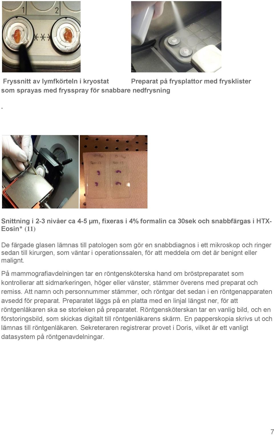 till kirurgen, som väntar i operationssalen, för att meddela om det är benignt eller malignt.