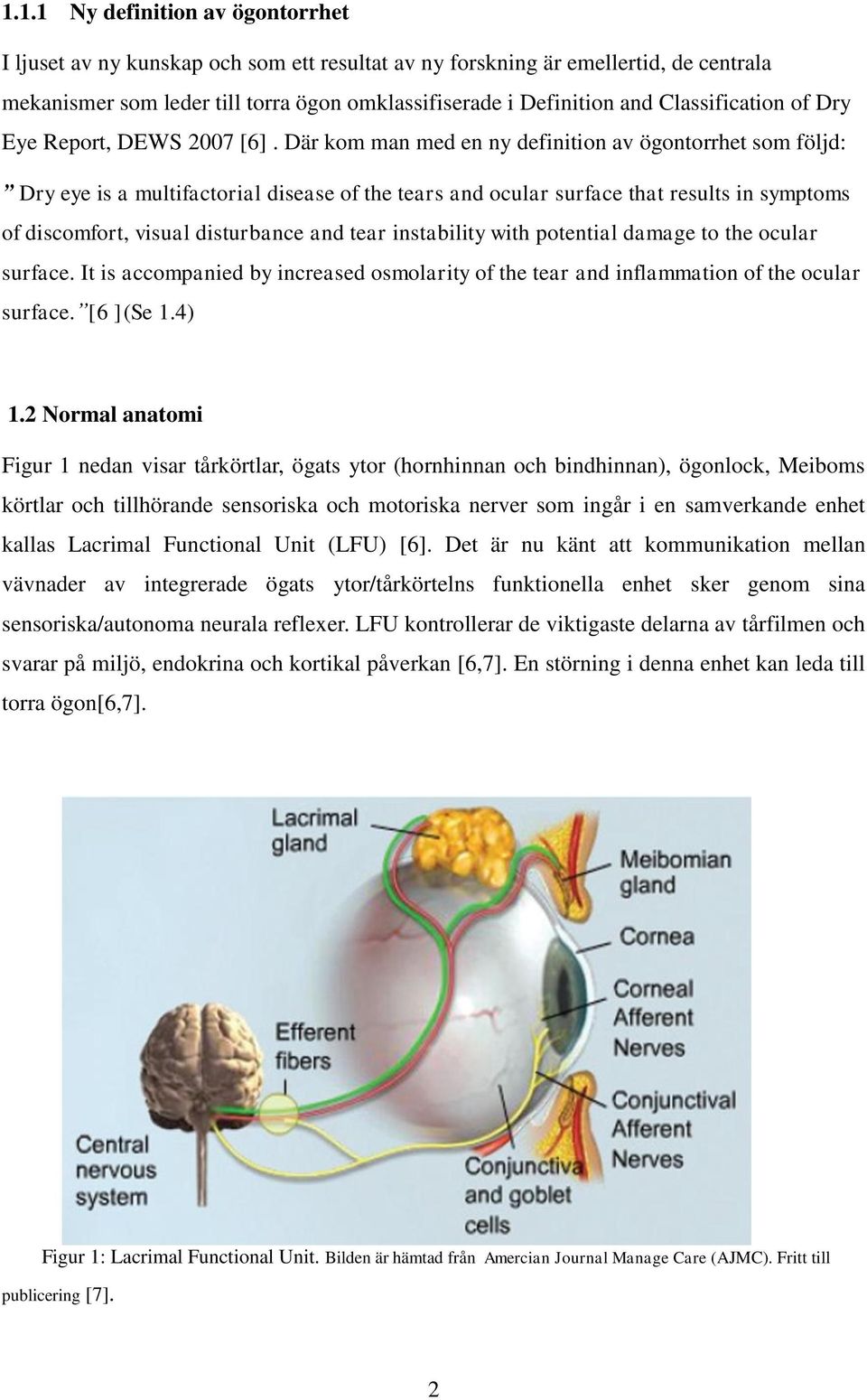 Där kom man med en ny definition av ögontorrhet som följd: Dry eye is a multifactorial disease of the tears and ocular surface that results in symptoms of discomfort, visual disturbance and tear