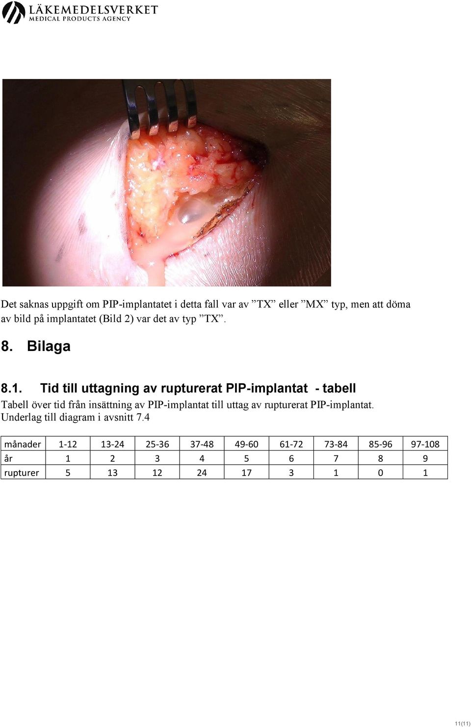 Tid till uttagning av rupturerat PIP-implantat - tabell Tabell över tid från insättning av PIP-implantat till