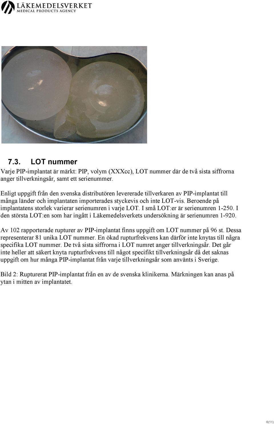 Beroende på implantatens storlek varierar serienumren i varje LOT. I små LOT:er är serienumren 1-250. I den största LOT:en som har ingått i Läkemedelsverkets undersökning är serienumren 1-920.