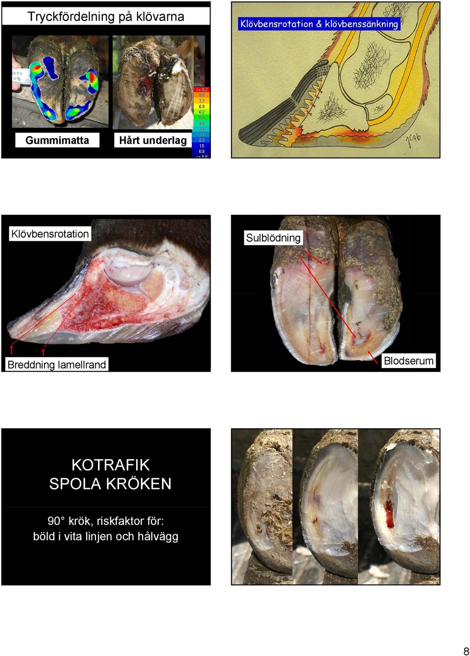 Klövbensrotation Sulblödning Breddning lamellrand