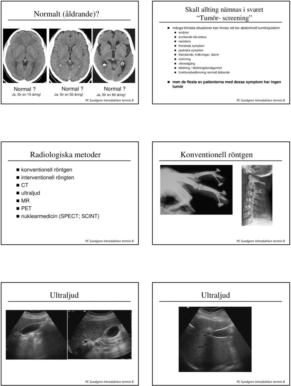 thorakala symptom psykiska symptom illamående, kräkningar, diarré svimning viktnedgång blödning / blödningsbenägenhet funktionsbedömning normalt åldrande