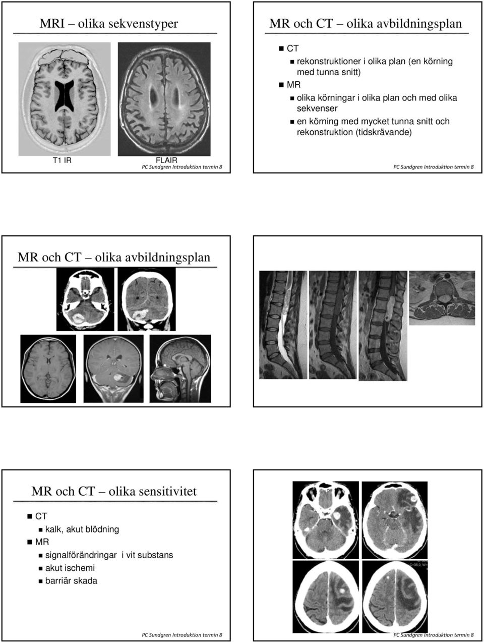 tunna snitt och rekonstruktion (tidskrävande) T1 IR FLAIR MR och CT olika avbildningsplan MR och CT