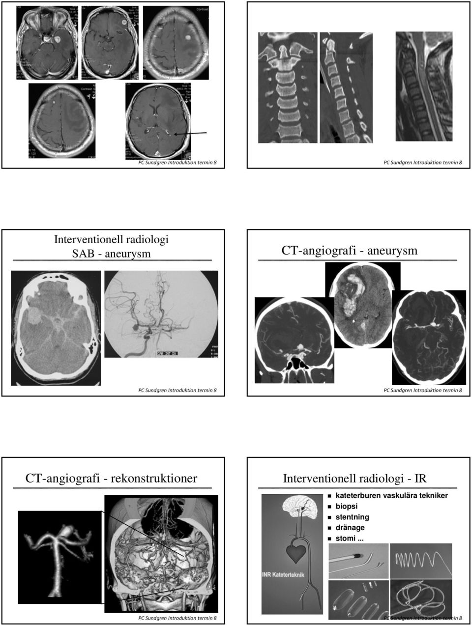 rekonstruktioner Interventionell radiologi - IR