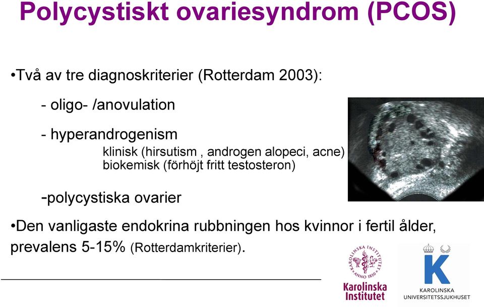 acne) biokemisk (förhöjt fritt testosteron) -polycystiska ovarier Den vanligaste