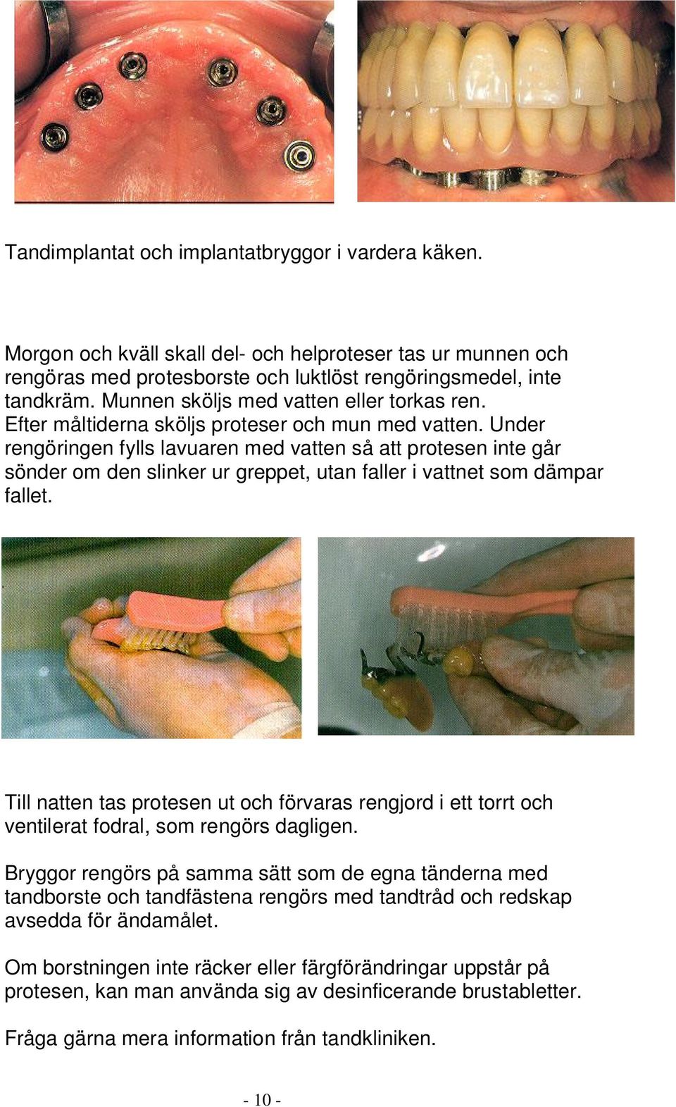 Under rengöringen fylls lavuaren med vatten så att protesen inte går sönder om den slinker ur greppet, utan faller i vattnet som dämpar fallet.