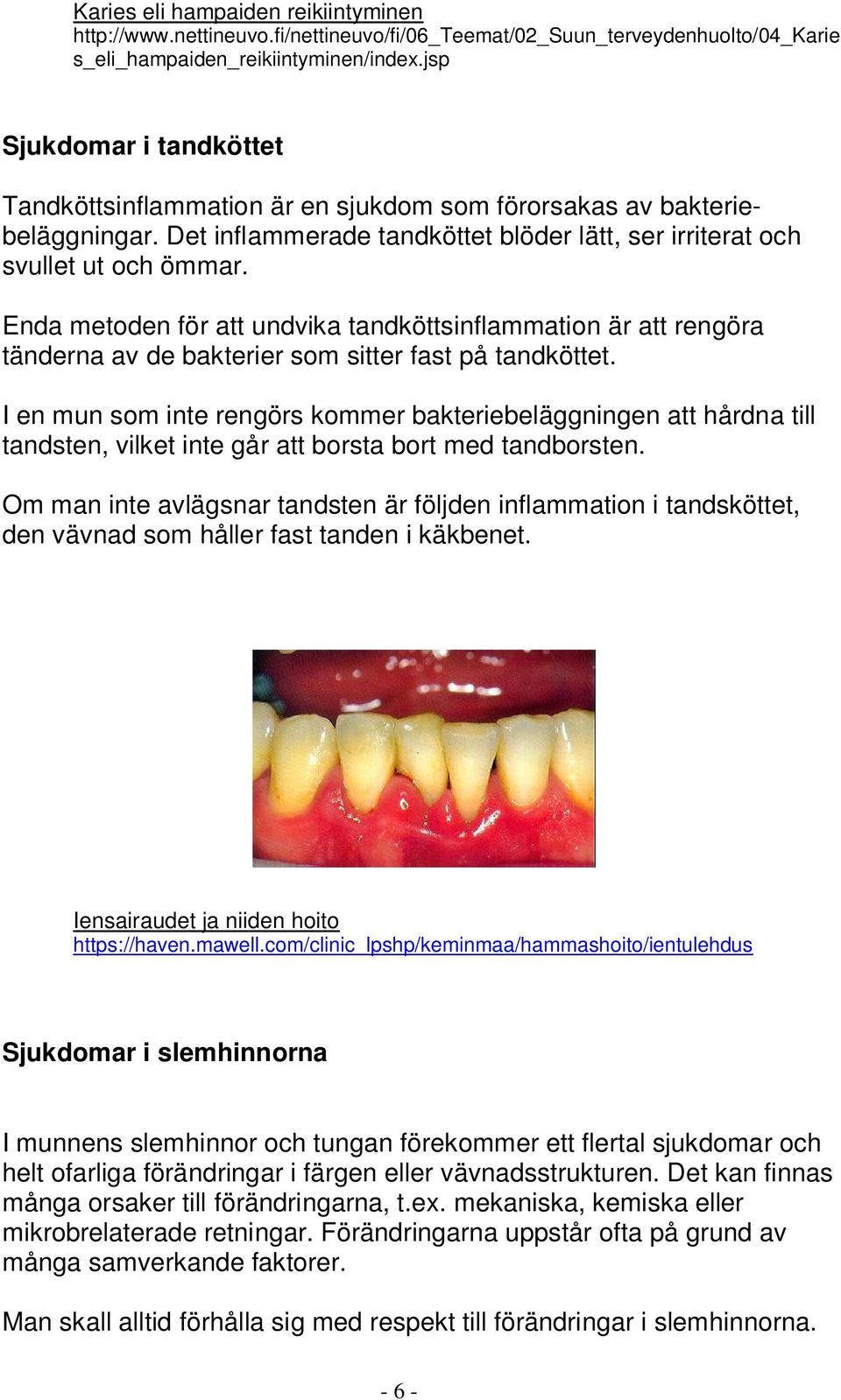 Enda metoden för att undvika tandköttsinflammation är att rengöra tänderna av de bakterier som sitter fast på tandköttet.