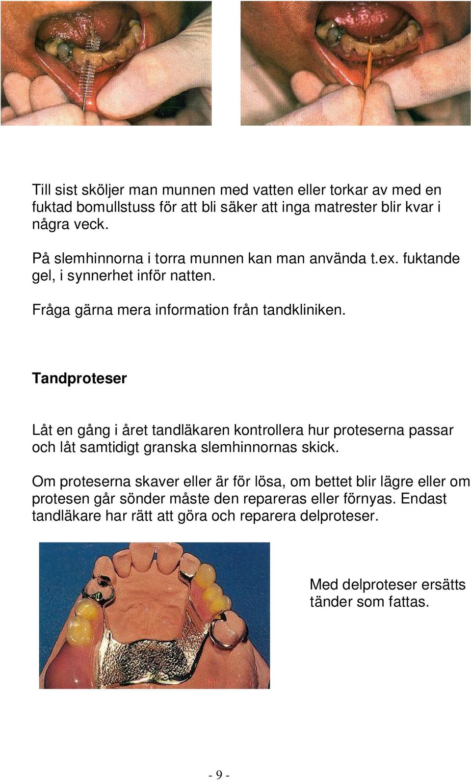 Tandproteser Låt en gång i året tandläkaren kontrollera hur proteserna passar och låt samtidigt granska slemhinnornas skick.
