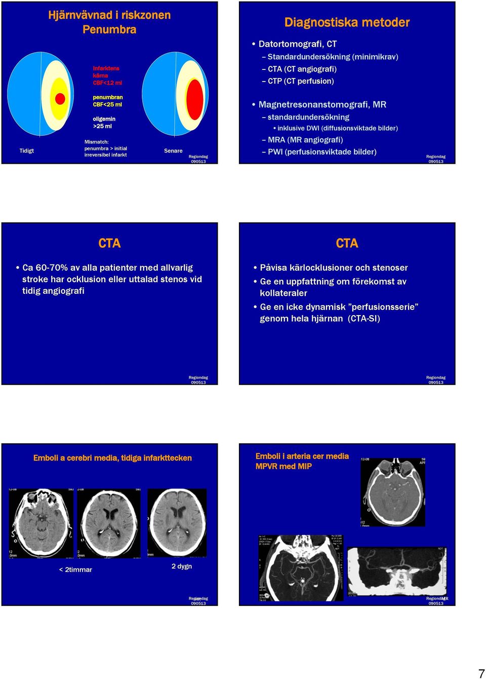 PWI (perfusionsviktade bilder) CTA CTA Ca 60-70% av alla patienter med allvarlig stroke har ocklusion eller uttalad stenos vid tidig angiografi Påvisa kärlocklusioner och stenoser Ge en