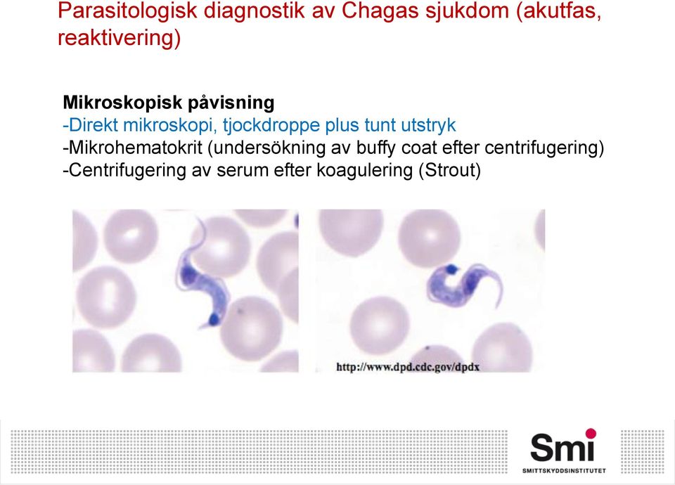 tjockdroppe plus tunt utstryk -Mikrohematokrit (undersökning av