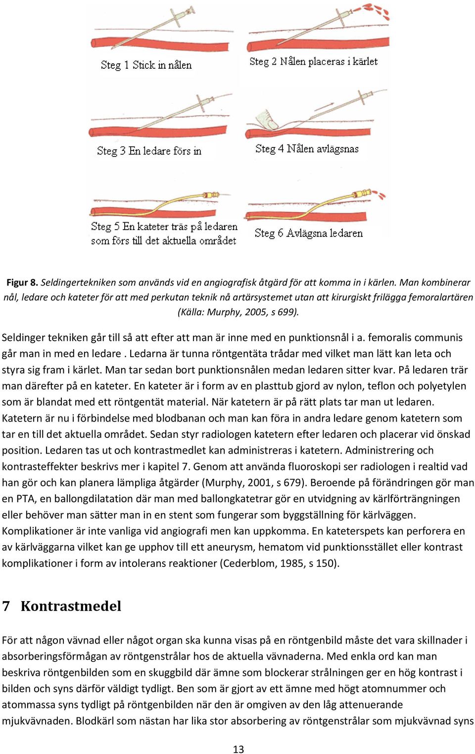Seldinger tekniken går till så att efter att man är inne med en punktionsnål i a. femoralis communis går man in med en ledare.