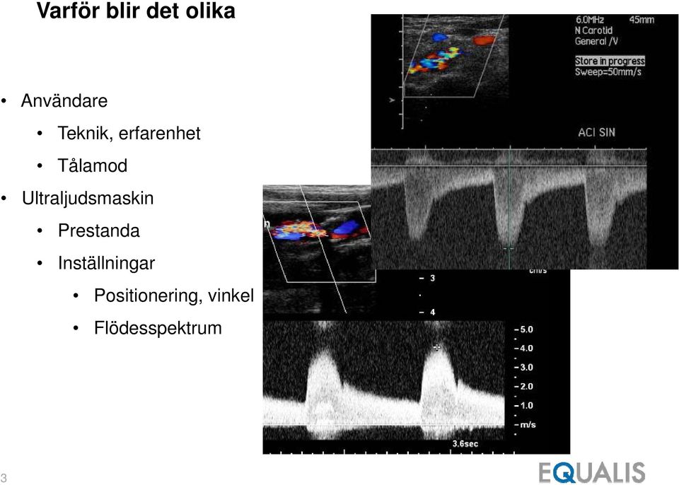 Ultraljudsmaskin Prestanda