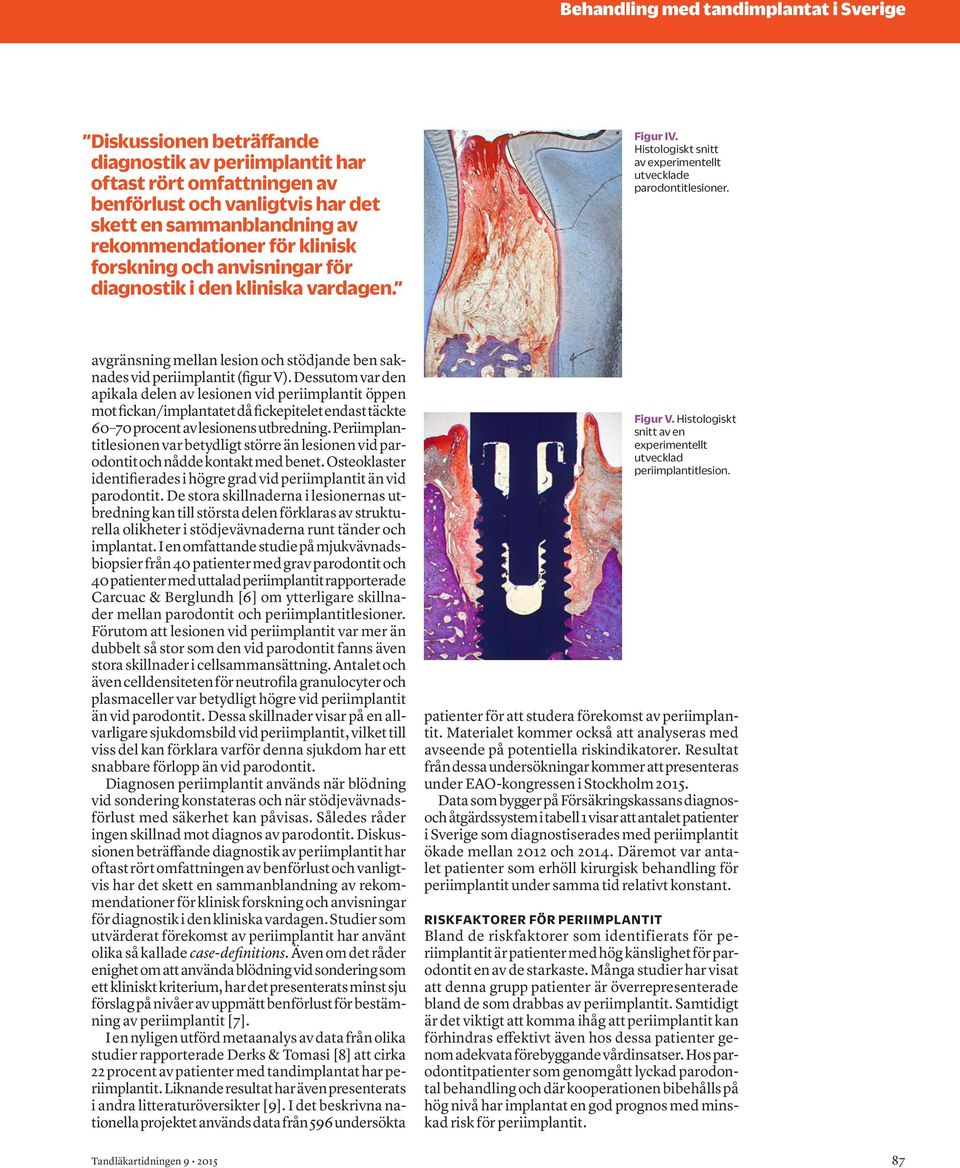 avgränsning mellan lesion och stödjande ben saknades vid periimplantit (figur V).