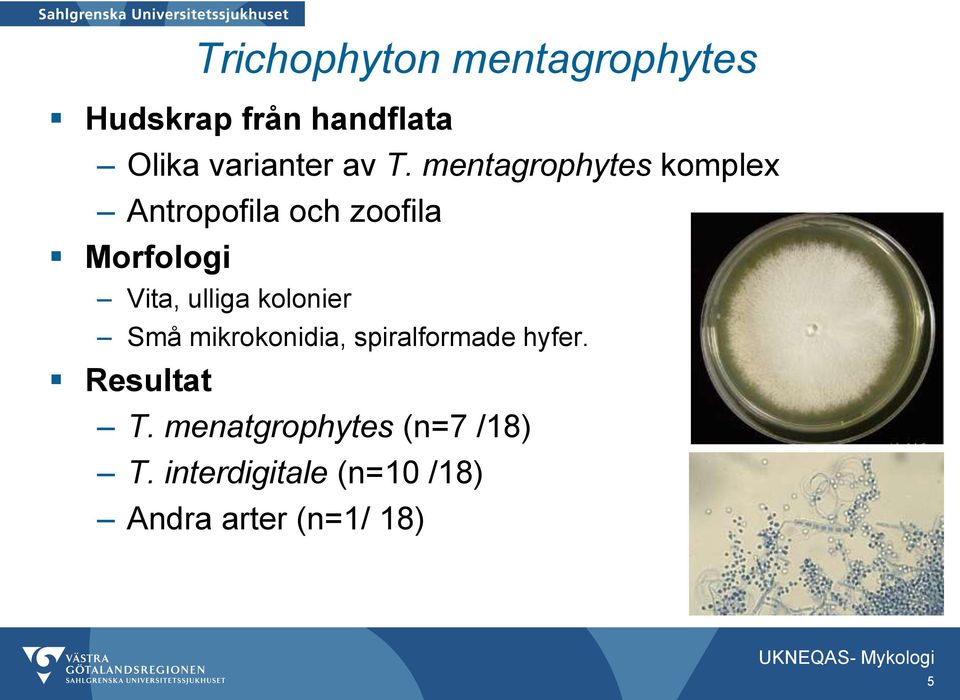 mentagrophytes komplex Antropofila och zoofila Vita, ulliga