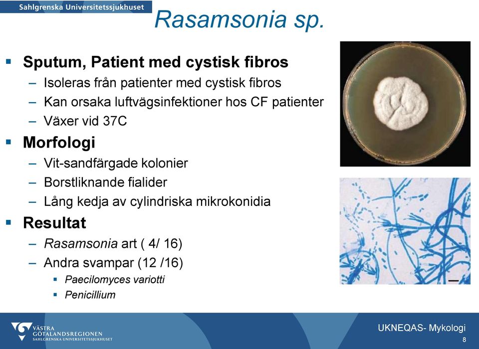 Kan orsaka luftvägsinfektioner hos CF patienter Växer vid 37C Vit-sandfärgade