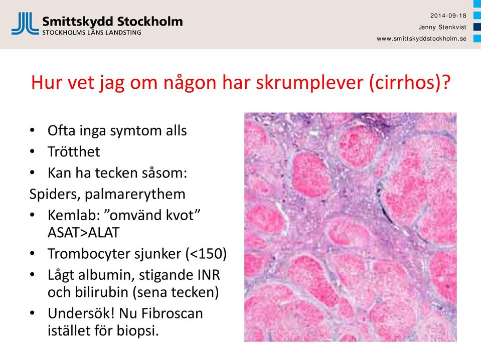 palmarerythem Kemlab: omvänd kvot ASAT>ALAT Trombocyter sjunker