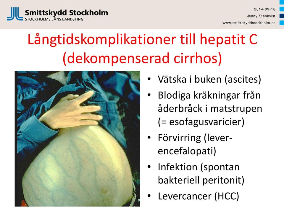 åderbråck i matstrupen (= esofagusvaricier) Förvirring
