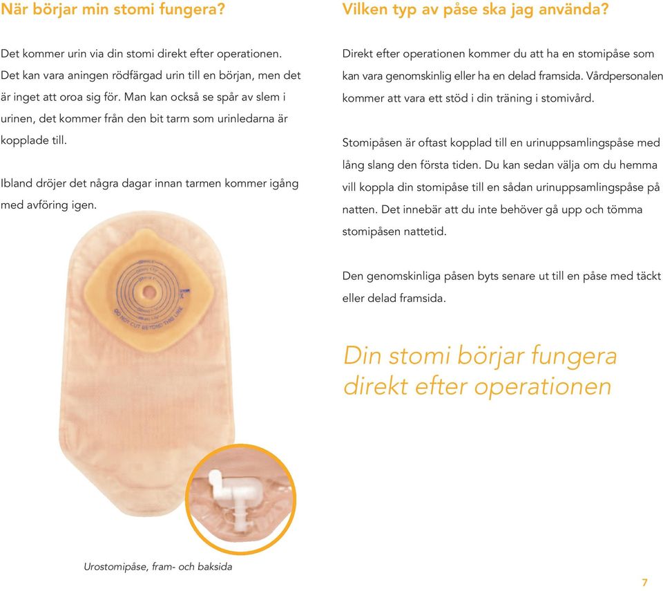 Ibland dröjer det några dagar innan tarmen kommer igång med avföring igen. Direkt efter operationen kommer du att ha en stomipåse som kan vara genomskinlig eller ha en delad framsida.
