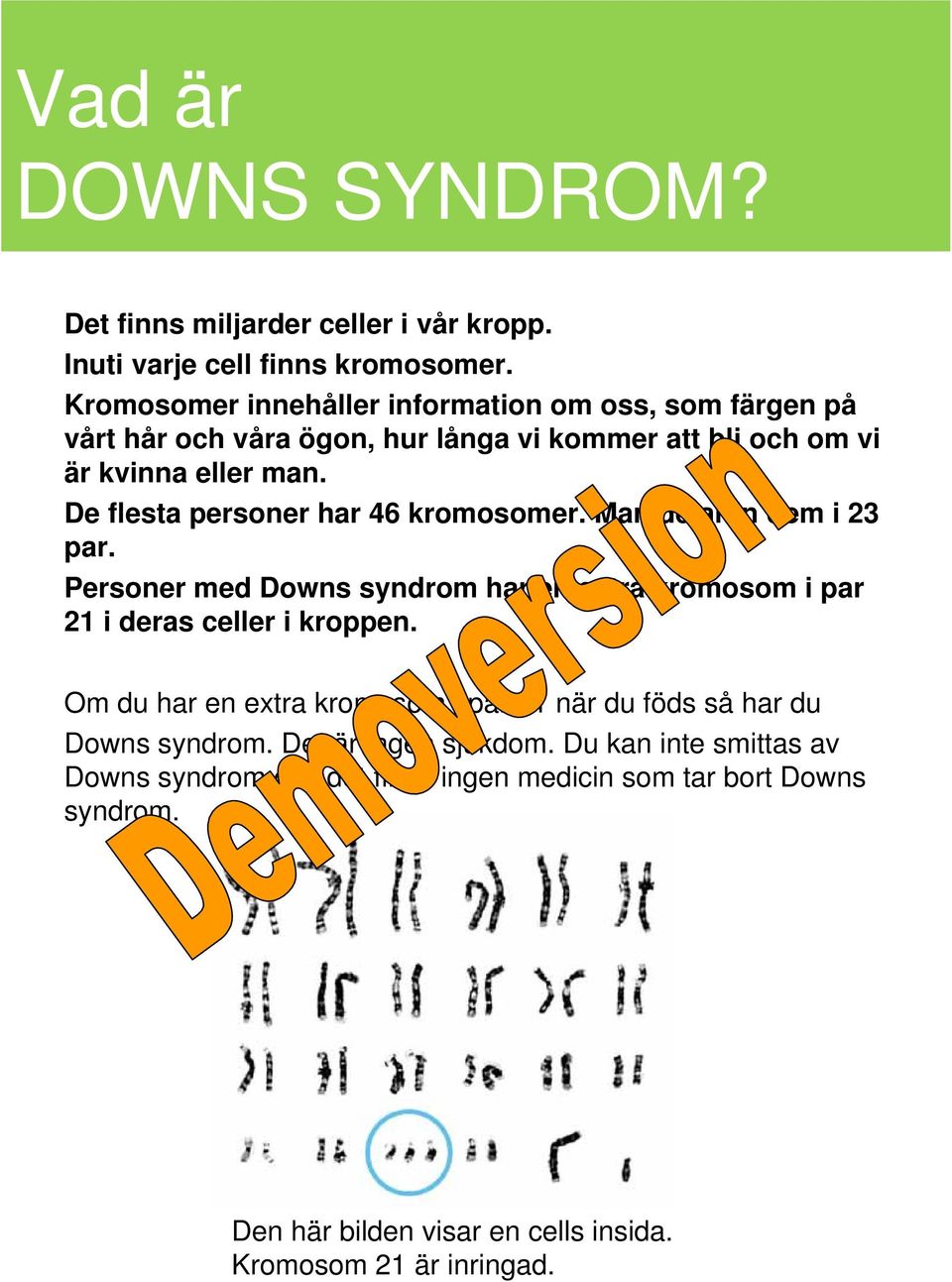 De flesta personer har 46 kromosomer. Man delar in dem i 23 par. Personer med Downs syndrom har en extra kromosom i par 21 i deras celler i kroppen.