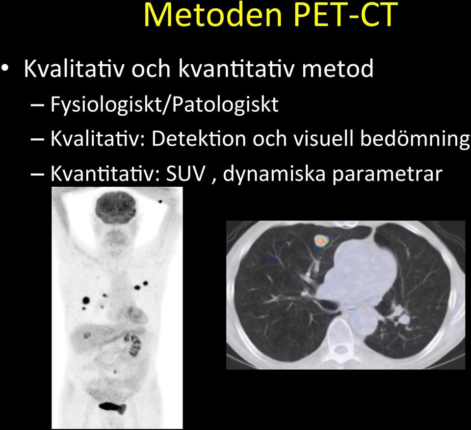 Fysiologiskt/Patologiskt Kvalita+v: