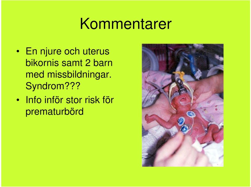 med missbildningar. Syndrom?