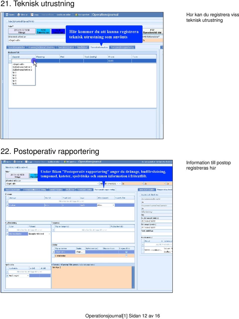 Postoperativ rapportering Information till