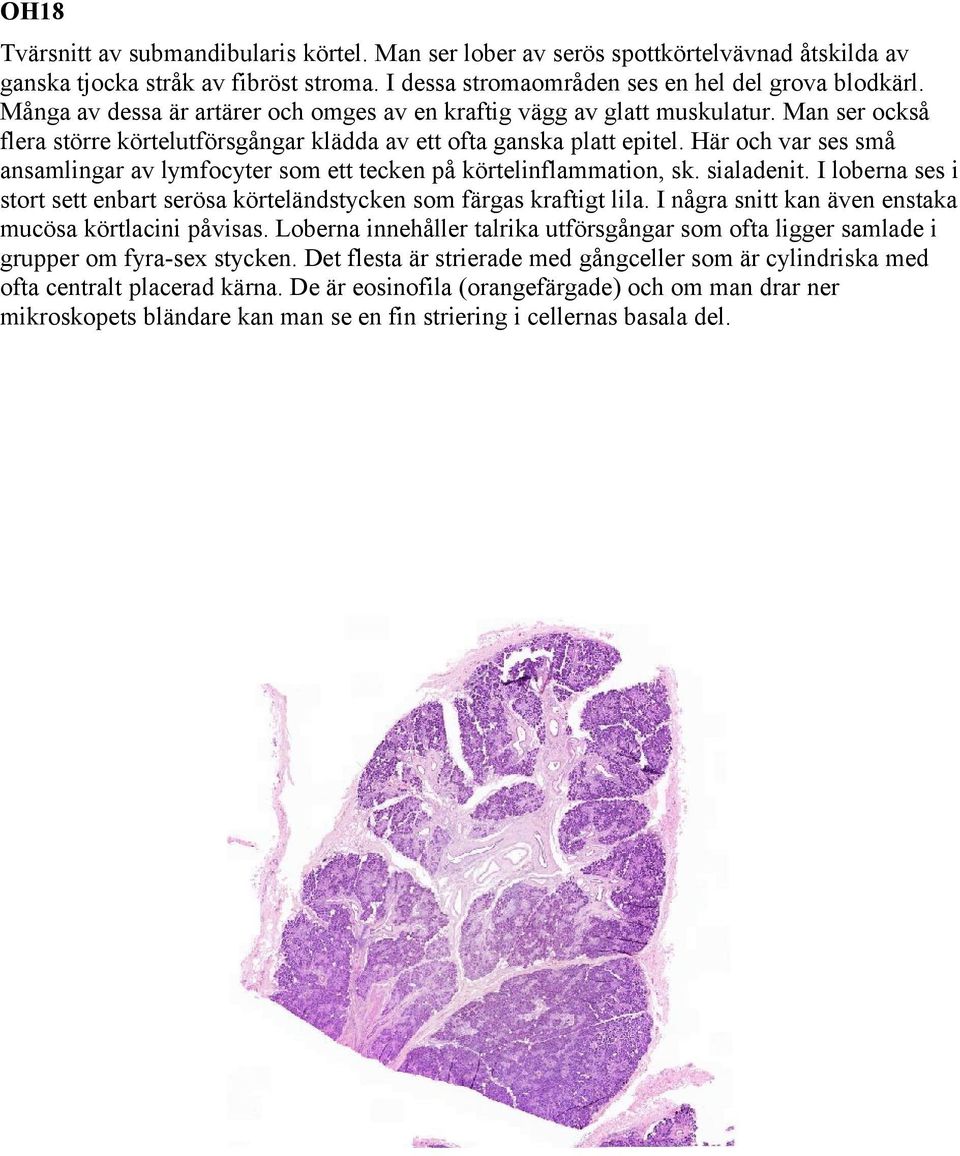 Här och var ses små ansamlingar av lymfocyter som ett tecken på körtelinflammation, sk. sialadenit. I loberna ses i stort sett enbart serösa körteländstycken som färgas kraftigt lila.