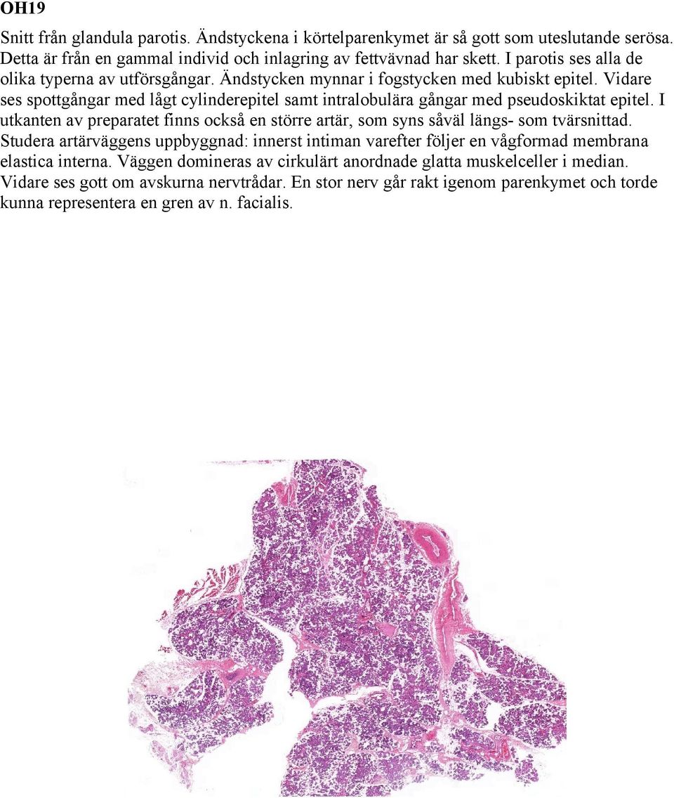 Vidare ses spottgångar med lågt cylinderepitel samt intralobulära gångar med pseudoskiktat epitel. I utkanten av preparatet finns också en större artär, som syns såväl längs- som tvärsnittad.