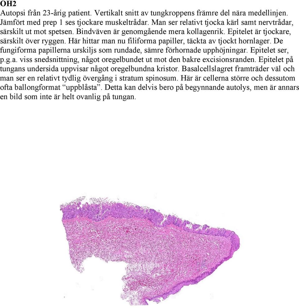 Här hittar man nu filiforma papiller, täckta av tjockt hornlager. De fungiforma papillerna urskiljs som rundade, sämre förhornade upphöjningar. Epitelet ser, p.g.a. viss snedsnittning, något oregelbundet ut mot den bakre excisionsranden.