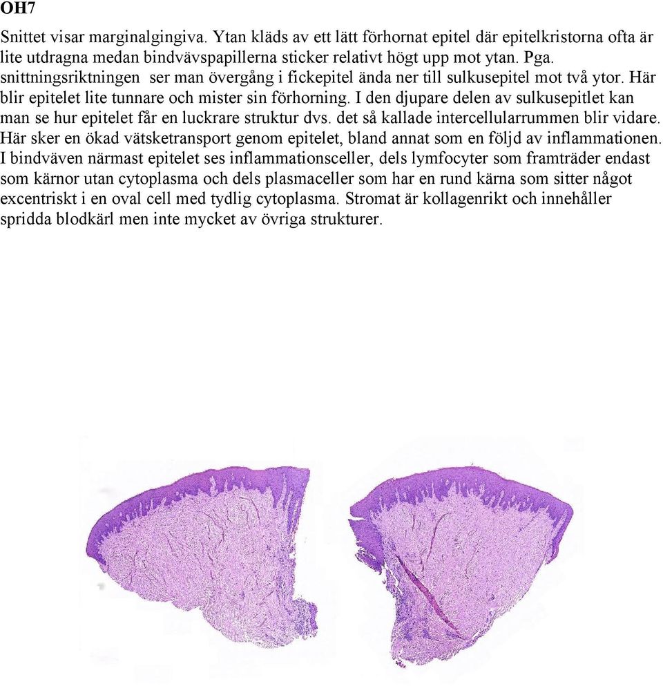 I den djupare delen av sulkusepitlet kan man se hur epitelet får en luckrare struktur dvs. det så kallade intercellularrummen blir vidare.