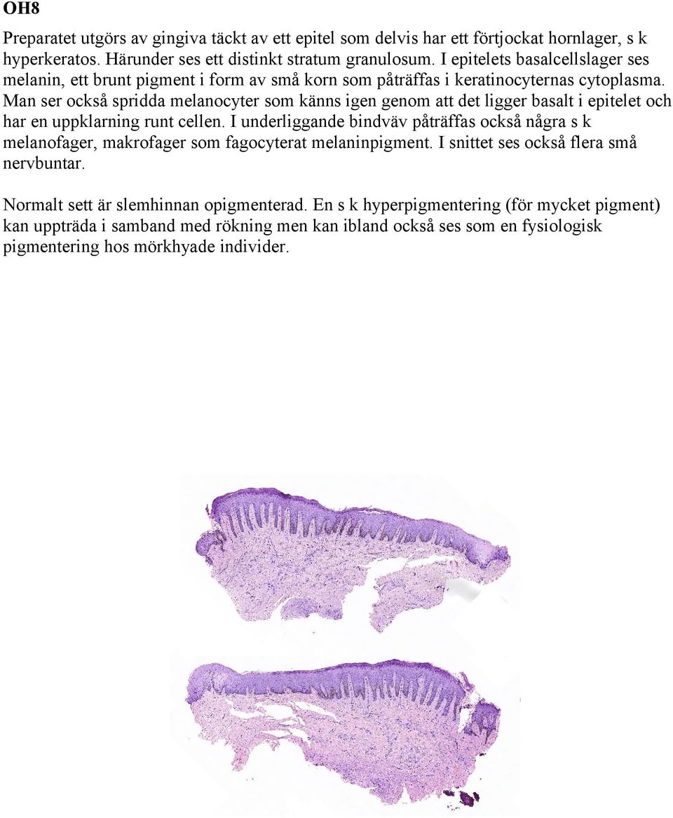 Man ser också spridda melanocyter som känns igen genom att det ligger basalt i epitelet och har en uppklarning runt cellen.