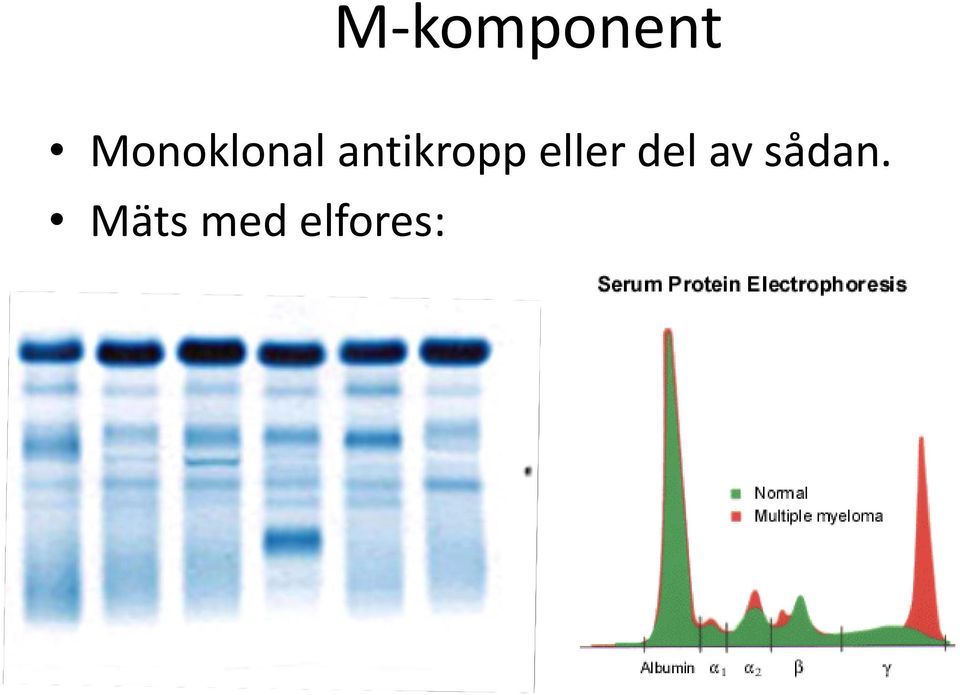 antikropp eller