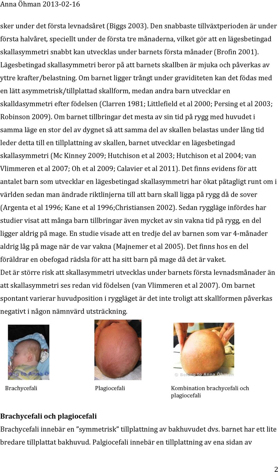 (Brofin 2001). Lägesbetingad skallasymmetri beror på att barnets skallben är mjuka och påverkas av yttre krafter/belastning.