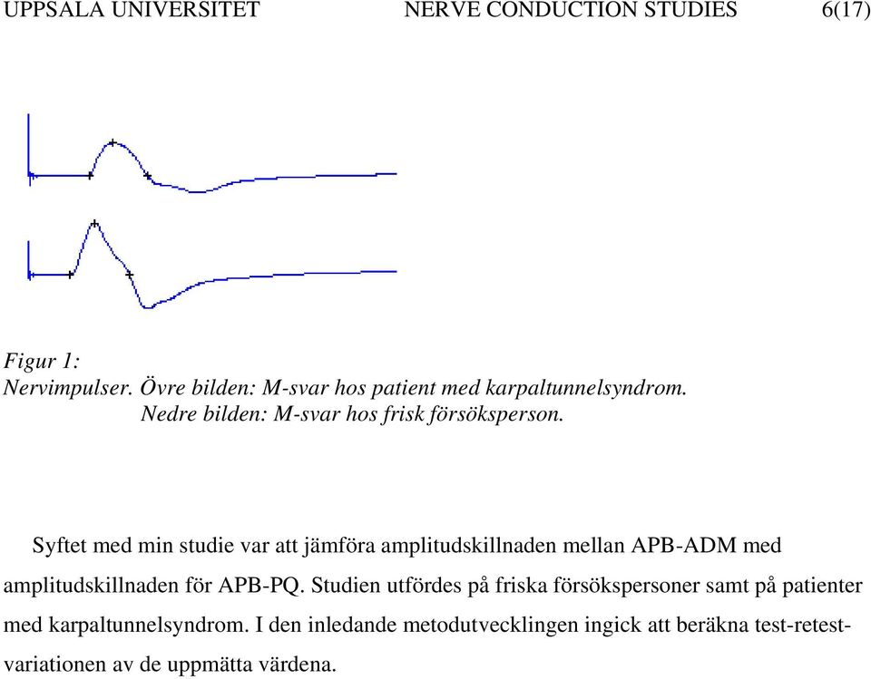 Syftet med min studie var att jämföra amplitudskillnaden mellan APB-ADM med amplitudskillnaden för APB-PQ.