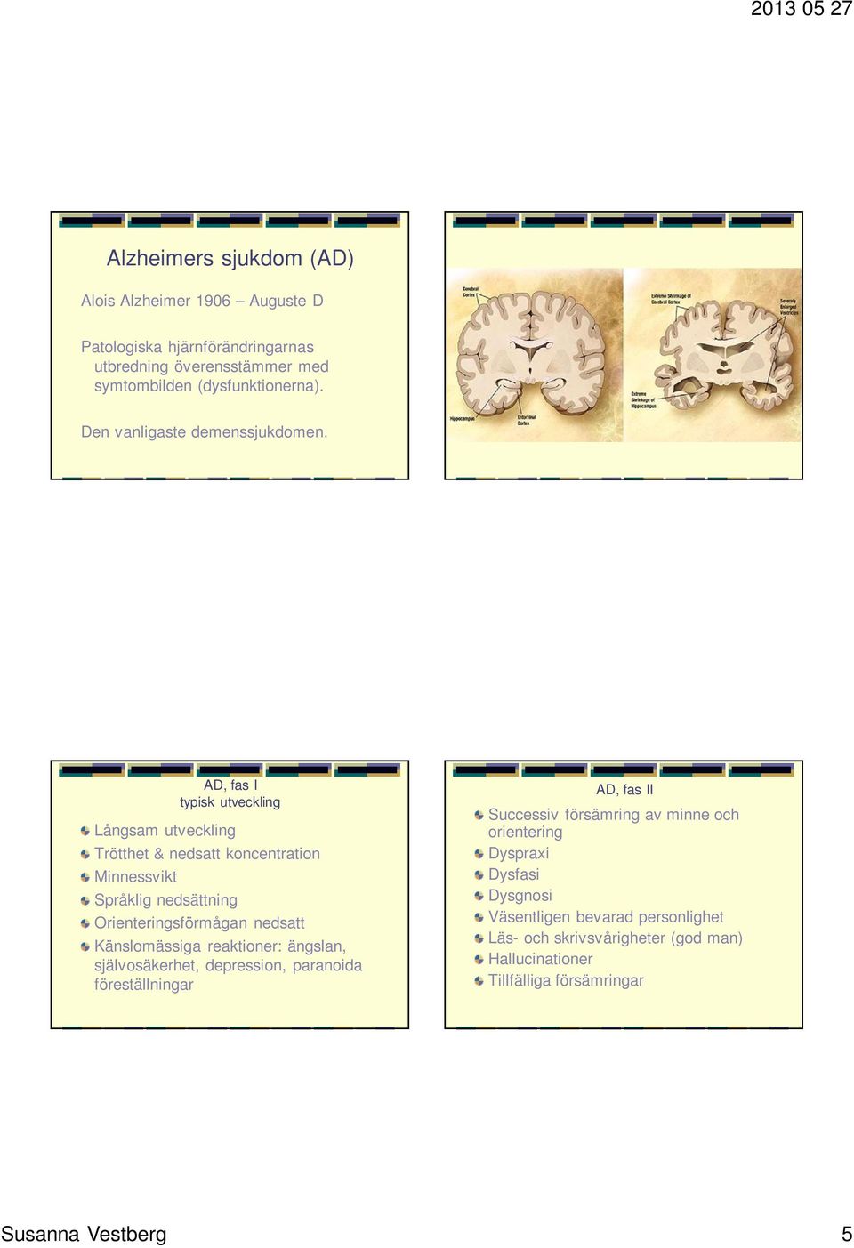 AD, fas I typisk utveckling Långsam utveckling Trötthet & nedsatt koncentration Minnessvikt Språklig nedsättning Orienteringsförmågan nedsatt Känslomässiga