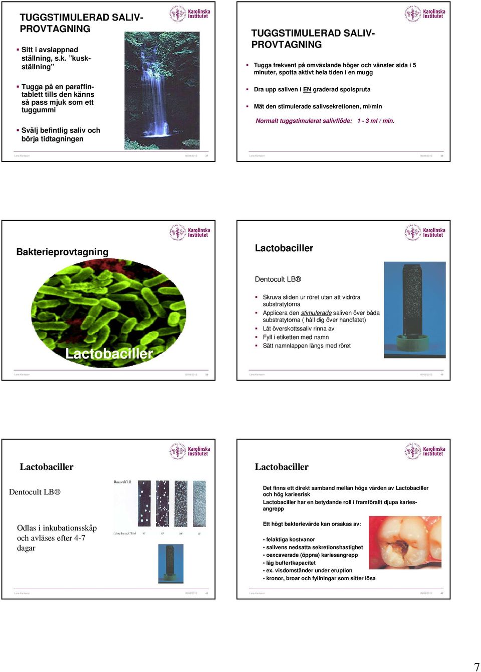 höger och vänster sida i 5 minuter, spotta aktivt hela tiden i en mugg Dra upp saliven i EN graderad spolspruta Mät den stimulerade salivsekretionen, ml/min Normalt tuggstimulerat salivflöde: 1-3 ml