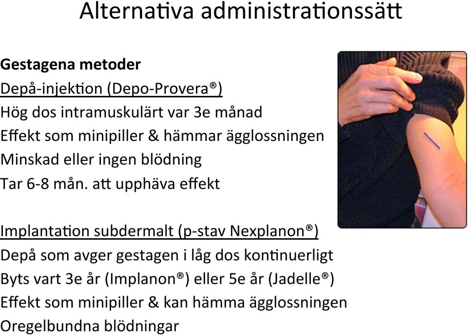 ao upphäva effekt Implanta#on subdermalt (p-stav Nexplanon ) Depå som avger gestagen i låg dos kon#nuerligt