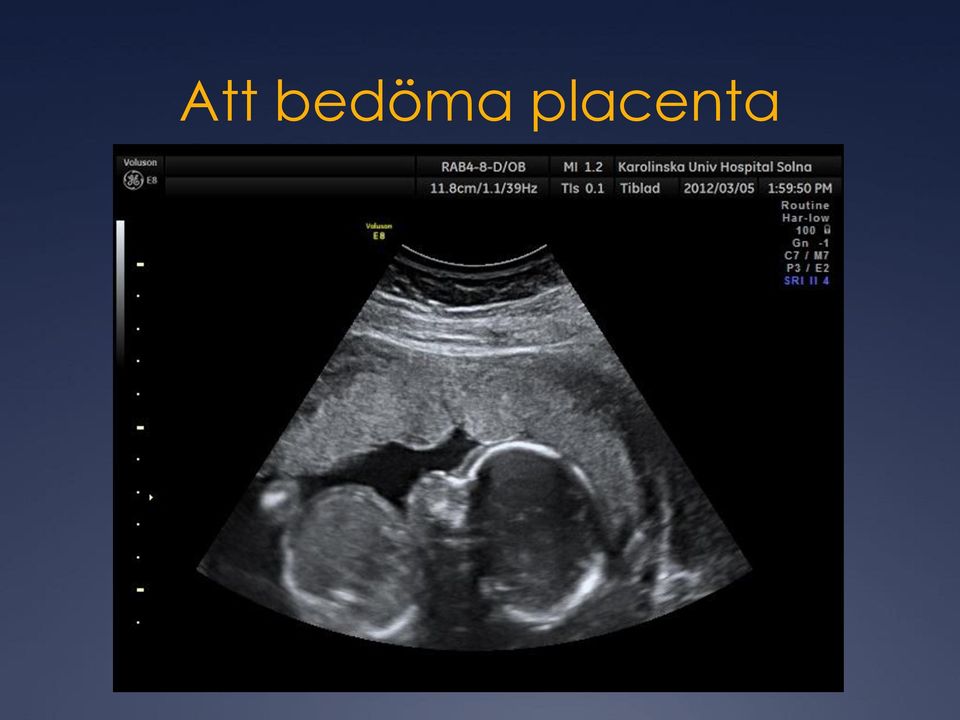 placenta