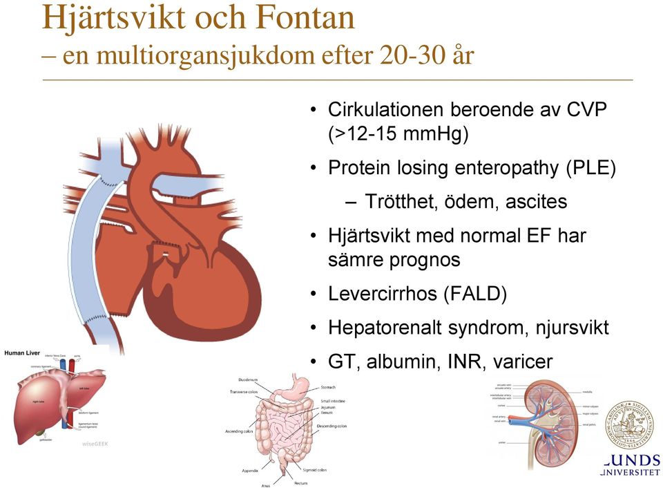 enteropathy (PLE) Trötthet, ödem, ascites Hjärtsvikt med normal EF