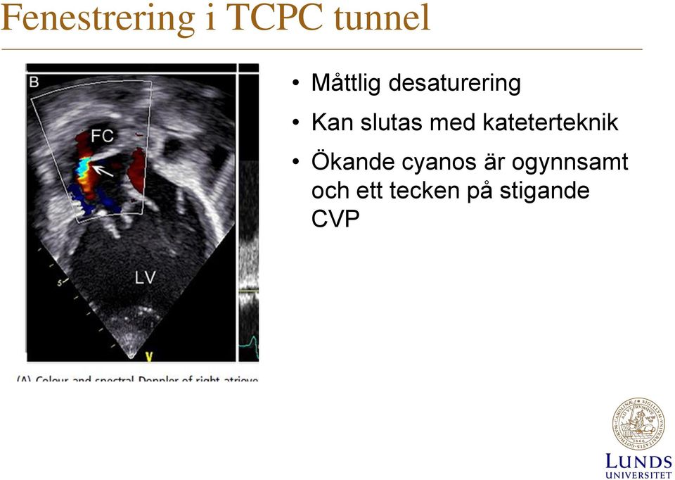 med kateterteknik Ökande cyanos