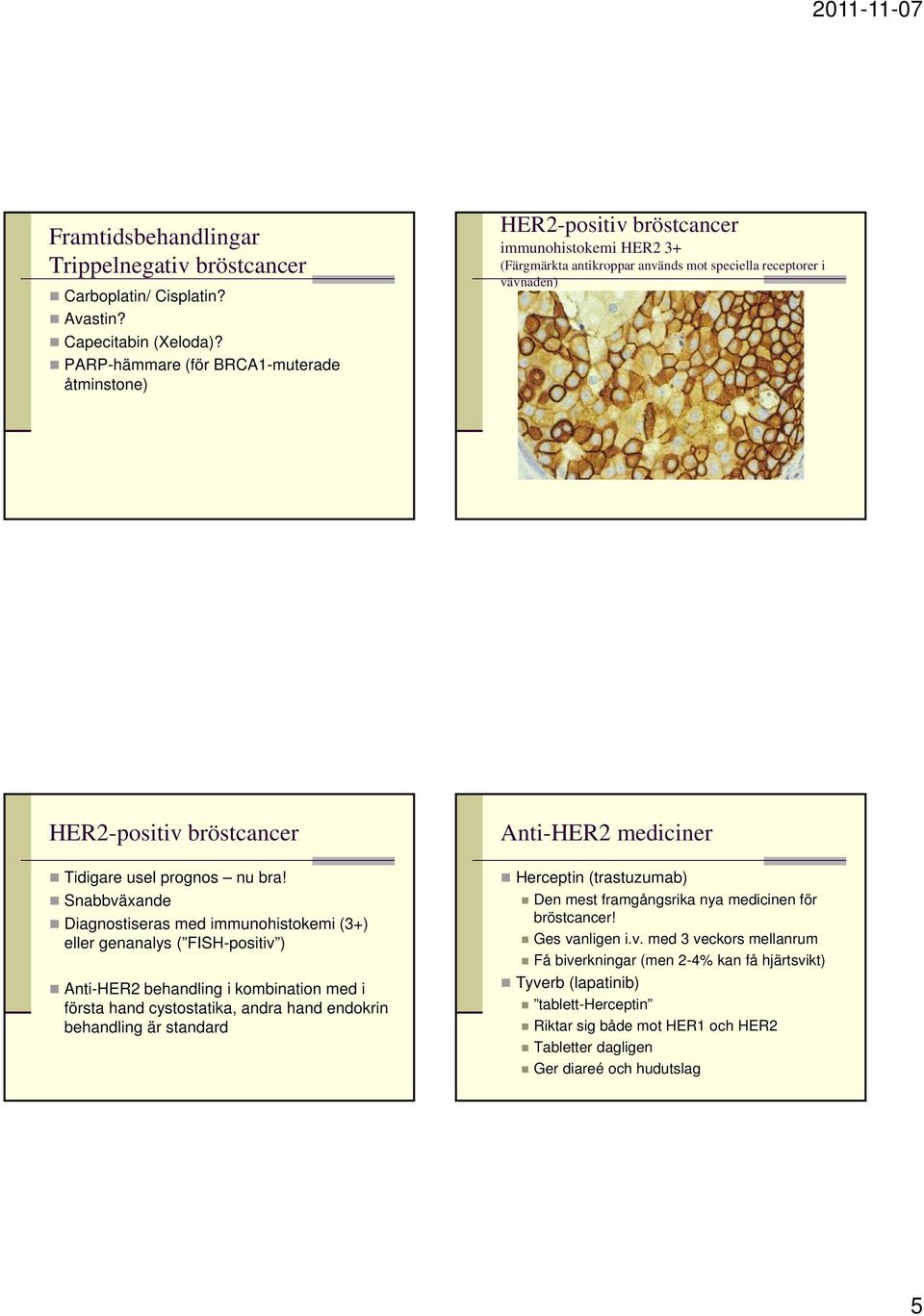 bra! Snabbväxande Diagnostiseras med immunohistokemi (3+) eller genanalys ( FISH-positiv ) Anti-HER2 behandling i kombination med i första hand cystostatika, andra hand endokrin behandling är