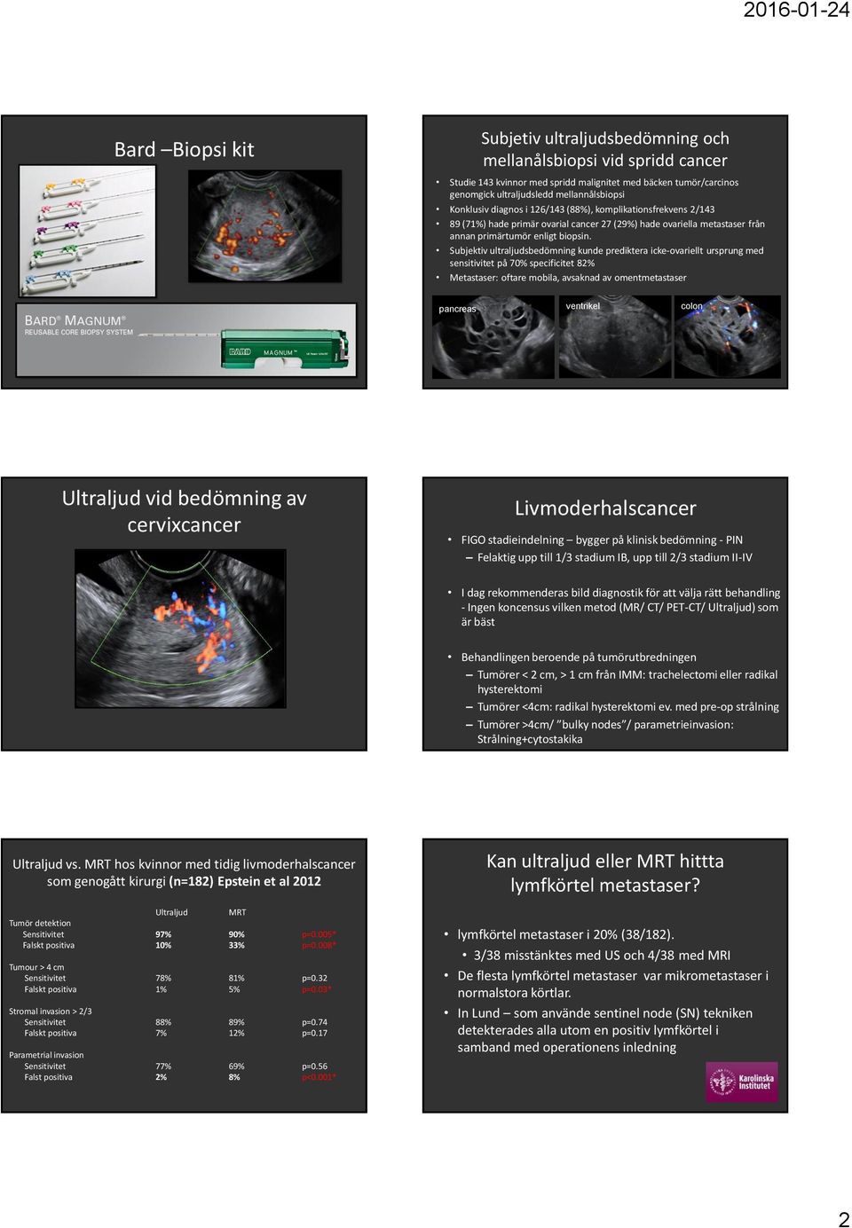 Subjektiv ultraljudsbedömning kunde prediktera icke-ovariellt ursprung med sensitivitet på 70% specificitet 82% Metastaser: oftare mobila, avsaknad av omentmetastaser pancreas ventrikel colon