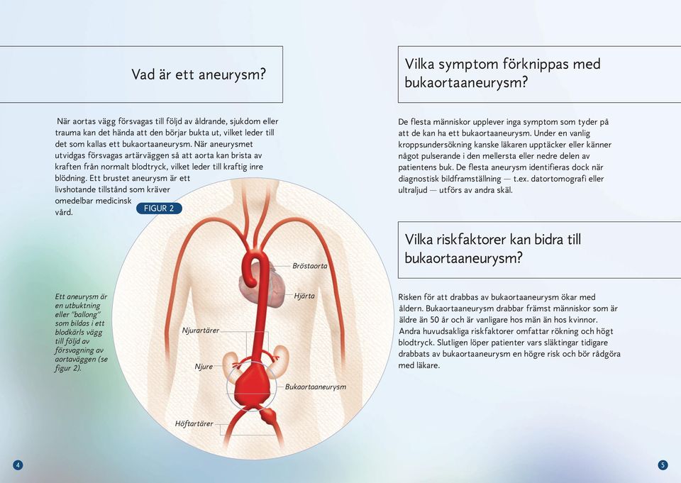 När aneurysmet utvidgas försvagas artärväggen så att aorta kan brista av kraften från normalt blodtryck, vilket leder till kraftig inre blödning.
