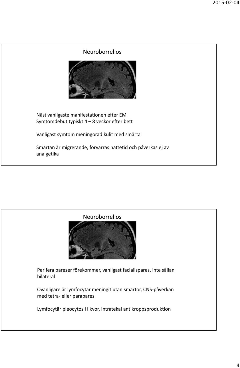 Perifera pareser förekommer, vanligast facialispares, inte sällan bilateral Ovanligare är lymfocytär meningit utan